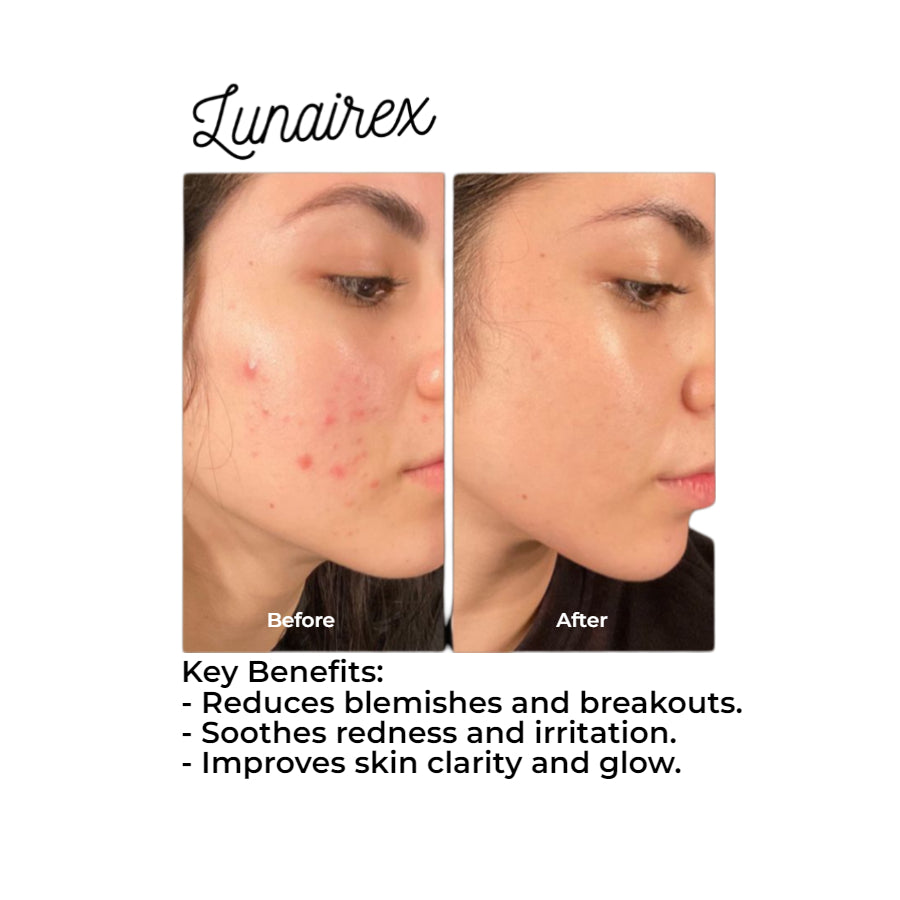 Lunairex™ Skin Tea-Trica Oil